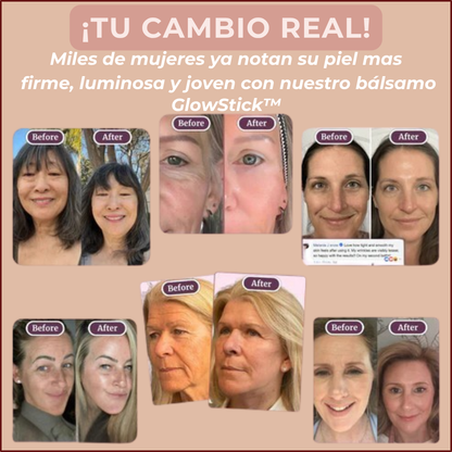 💎¡Tu piel no esta cansada...solo le faltaba GlowStick™ para recuperar su brillo y frescura al instante!.